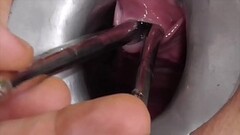 Amateur FreyjaAnalslut:  Multiple Sounds - James is stretching Freyja'_s urethra with multiple s Thumb
